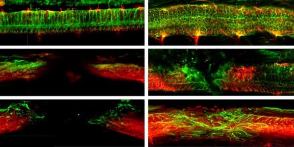 MOUSE WALKS AGAIN AFTER SEVERED SPINAL CORD